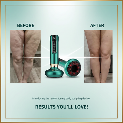 Anti-Cellulite Massager
